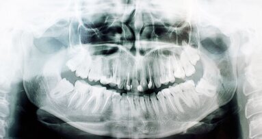 Leeftijd schatten op basis van verstandskiezen niet wetenschappelijk onderbouwd