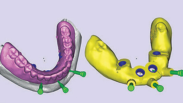 Reduce treatment time with digital dentistry