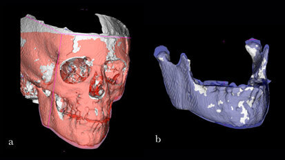 L’ortodonzia digitale…  a portata di click