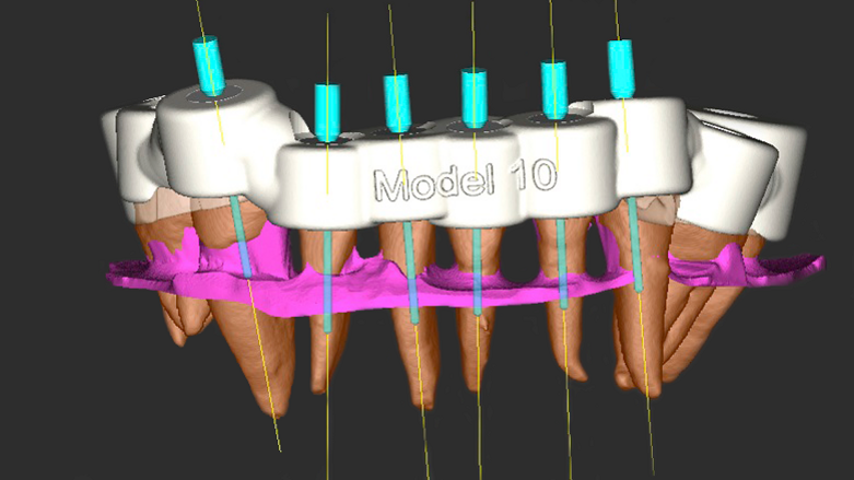 Research team receive multiple awards for micro-guided endodontics technique