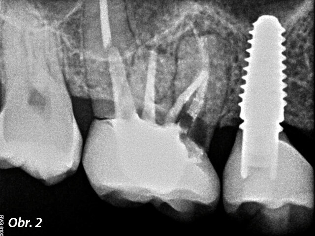 Radiografické vyšetření