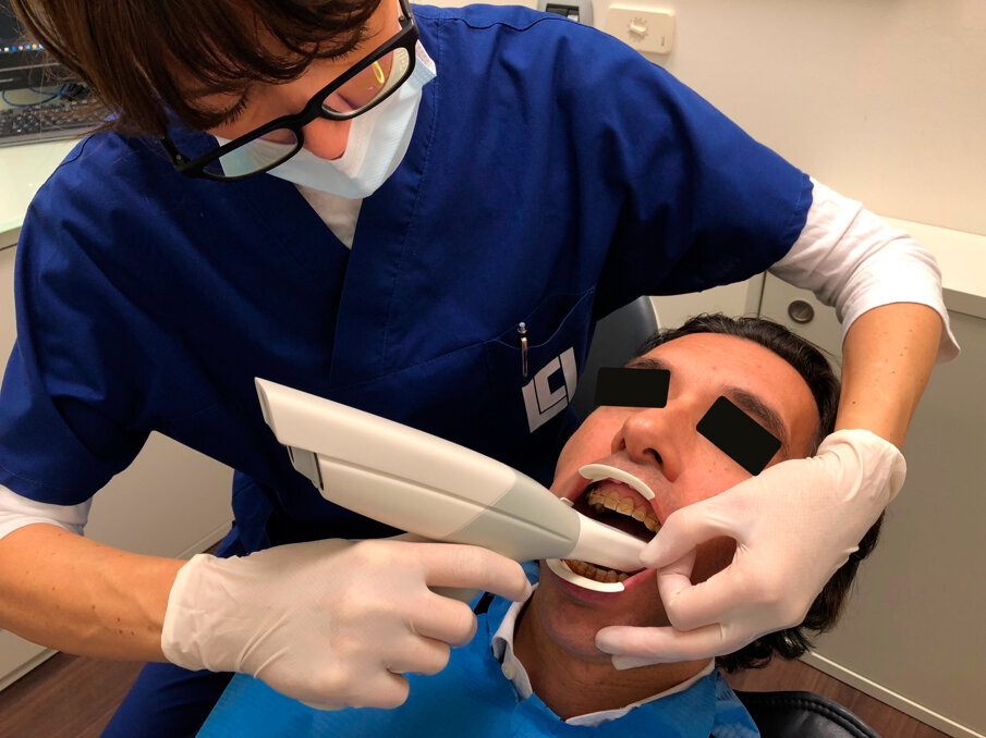 Fig. 4 - Ergonomia della scansione intraorale. Un operatore esperto impiega 4/6 minuti per ottenere una scansione completa delle arcate. Altri 5 minuti per la pulizia dell’immagine e invio.