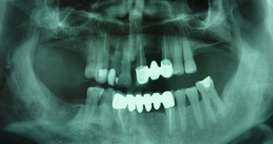 ATM e colpo di frusta: un nuovo modo di vedere le cose