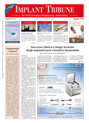 Implant Tribune Italy Implant Tribune Italy