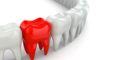 Amis vs. Briten – wer hat bessere Zähne?