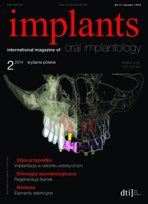 implants Poland No. 2, 2014 implants Poland No. 2, 2014