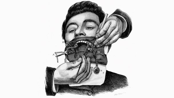 Festeggiamo il 150° della diga di gomma