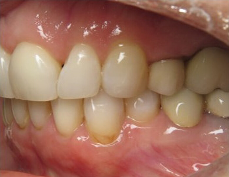 Fig. 8d