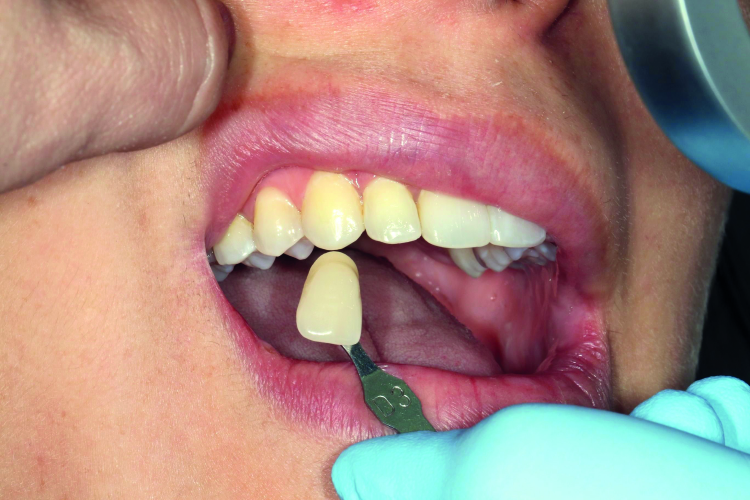 Fig. 4: Initial situation.