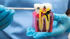 Researchers uncover gene teamwork behind tooth root formation