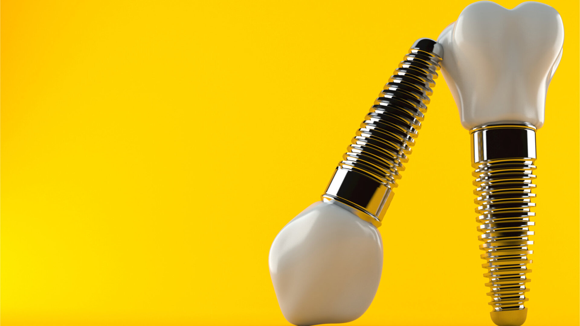 Trends in dentistry: What is currently happening in implantology?