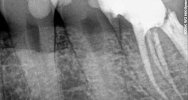 The last microscope skeptic