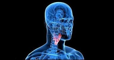 Przełom w badaniach dotyczących wirusa HPV powiązanego z rakiem jamy ustnej