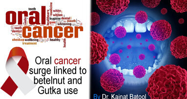 Oral cancer surge linked to betelnut and Gutka use