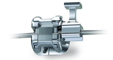 Ormco announces launch of the first and only repositionable hook on the market