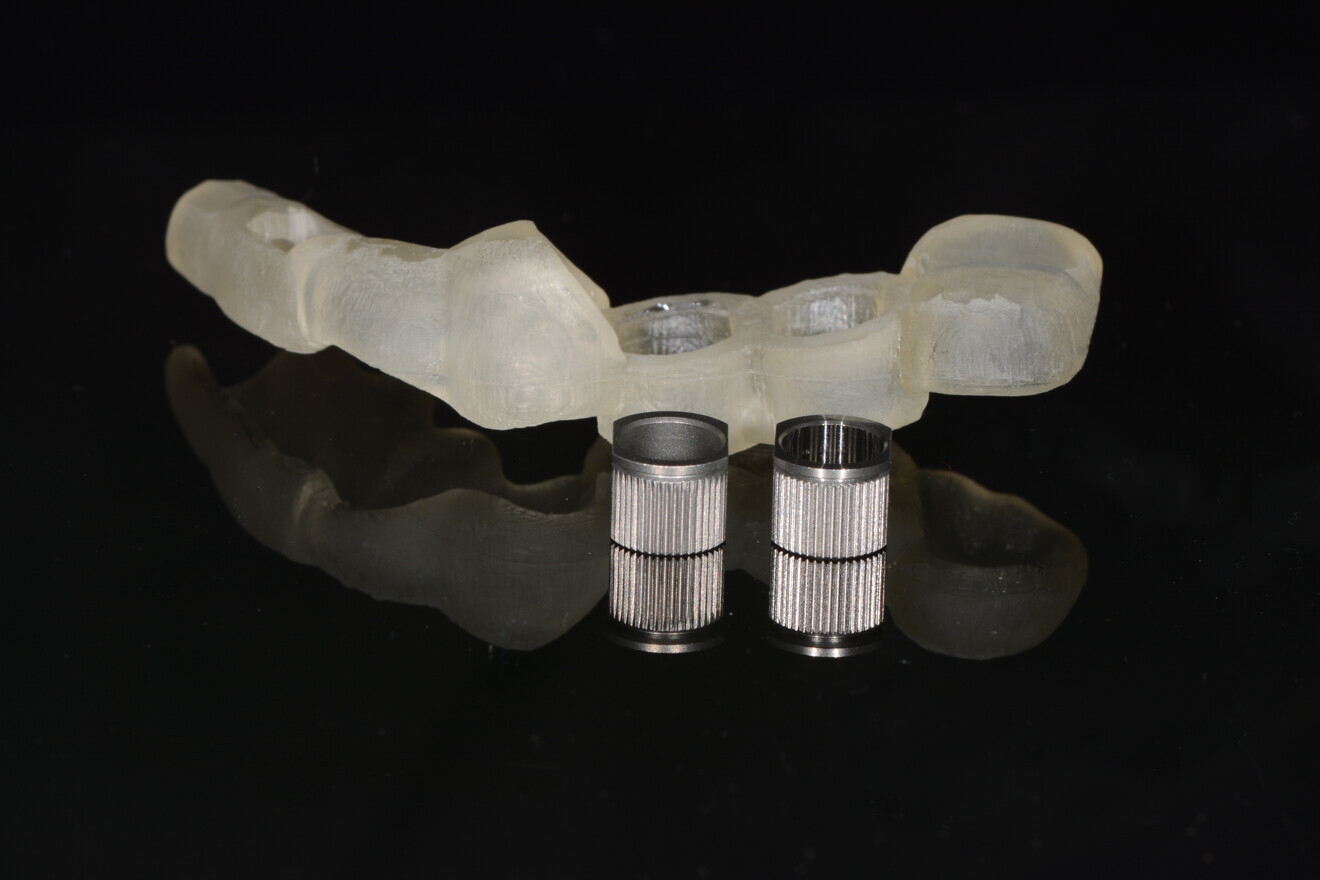 Fig. 7: Surgical guide after the supporting structures had been detached, and the corresponding drilling sleeves before their insertion.