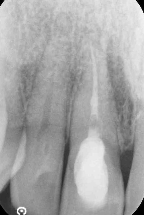 Situazione giugno 2017.