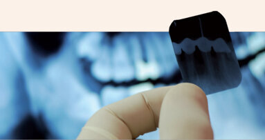 Vědci varují: zubní rentgeny zvyšují riziko vzniku rakoviny
