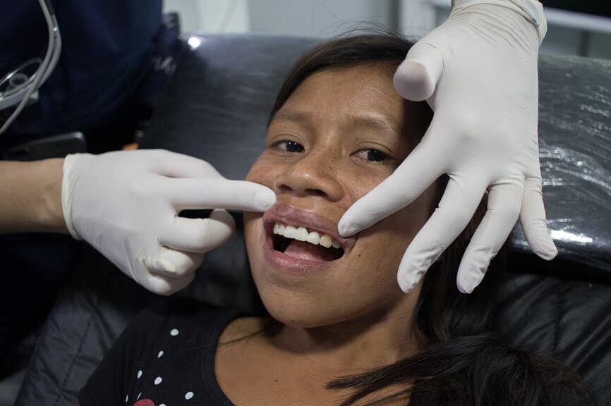 O resultado depois da fixação de uma ponte fabricada com o CEREC. (Fotografia: Dentsply Sirona)