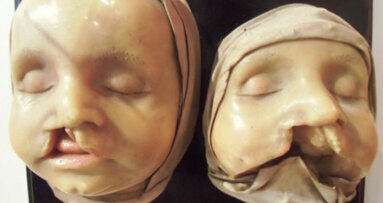 Schau über Alltag der Zahnärzte von anno dazumal