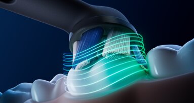 Periodontal disease carries a measurable environmental cost