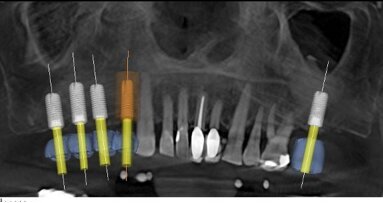 Une fois que vous l'avez essayé, vous ne pouvez plus boire autre chose