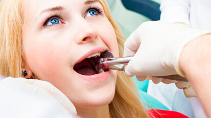 In Australia costano milioni le estrazioni di terzi molari non necessarie