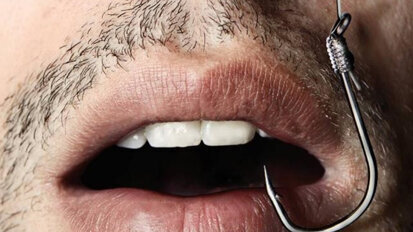 El catastrófico boom de los diseños de sonrisa