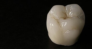 Golden Parallelometer 2011 Yarışması