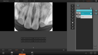 Компания 3DISC выводит на рынок новую стоматологическую рентгенологическую систему