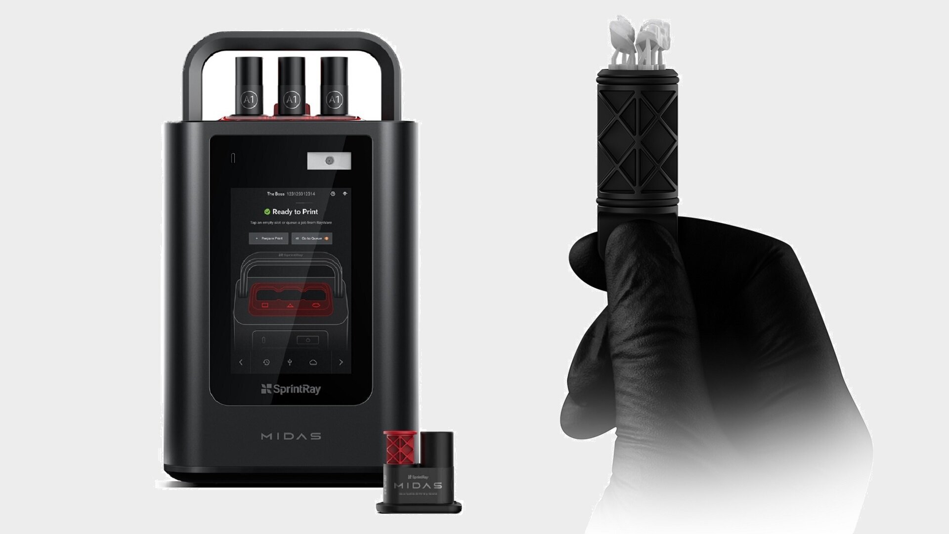 Single-appointment 3D printing of inlays and onlays with Midas