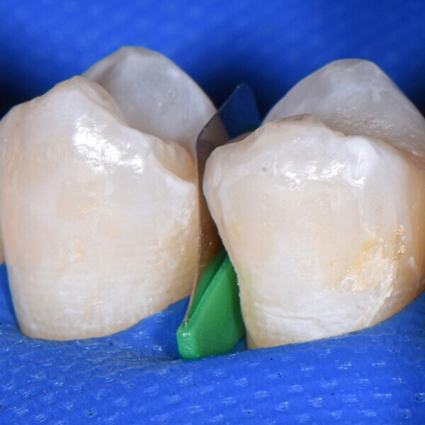 (image: Directa Dental)