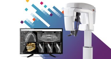 La Neo Edition della famiglia CS 8200 3D rende il sistema CBCT ancora più intuitivo