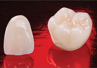 Glidewell Laboratories introduces Obsidian lithium silicate ceramic crowns Glidewell Laboratories introduces Obsidian lithium silicate ceramic crowns