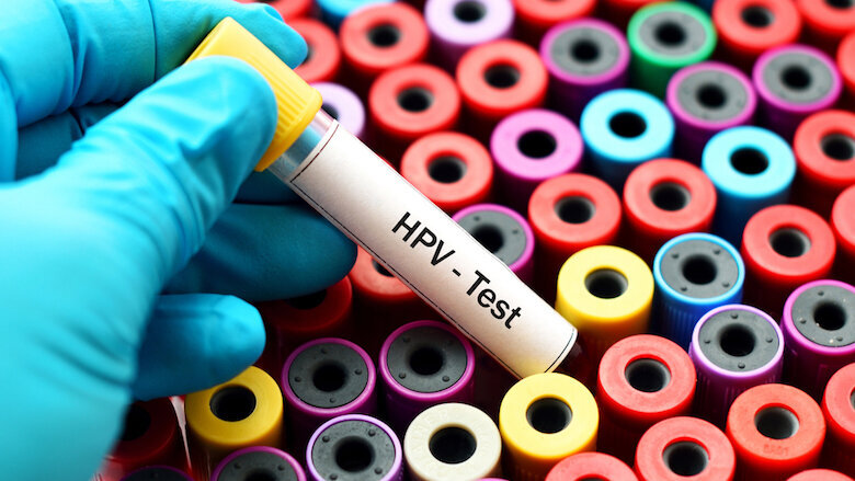 Study shows HPV infection rates lower than expected