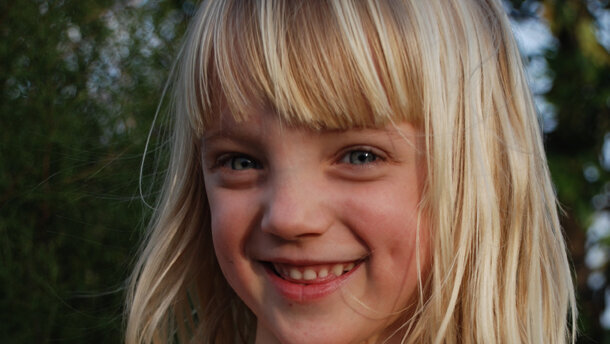 Perdita precoce dei denti decidui