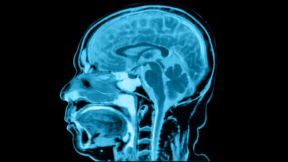 Man loses memory after root canal treatment