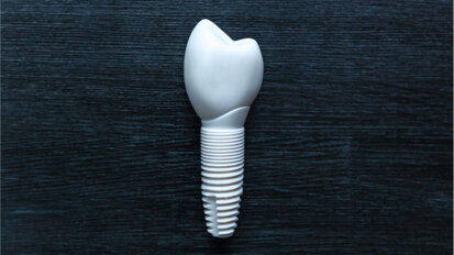 New production process promises to make dental ceramic implants more resilient New production process promises to make dental ceramic implants more resilient