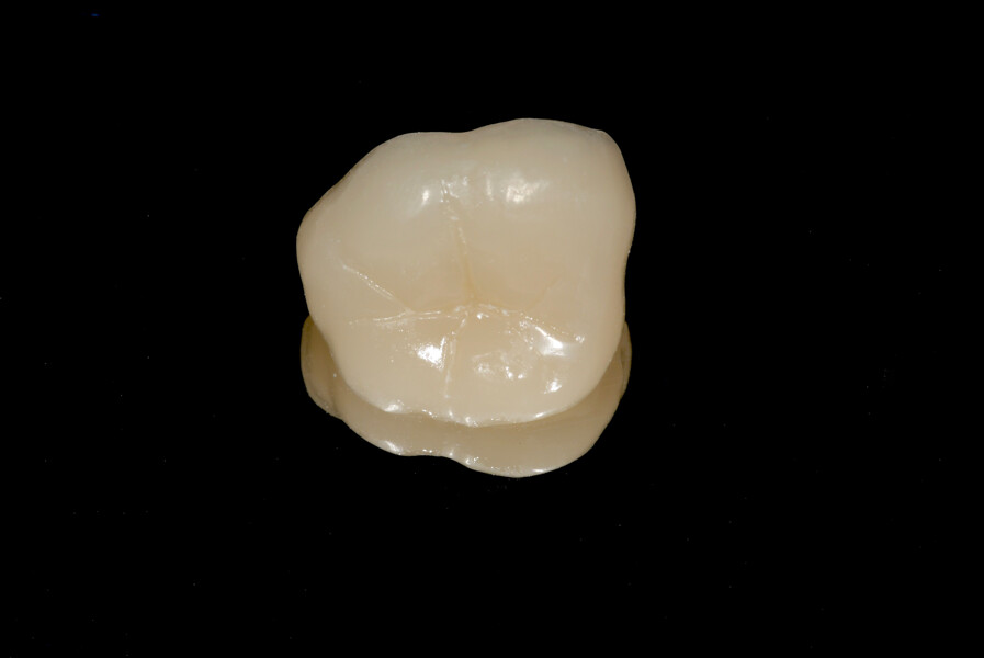 Fig. 21a: Milled resin composite endocrown after characterisation and polishing, occlusal.