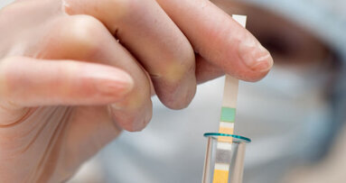 New research adds colour to gum disease detection