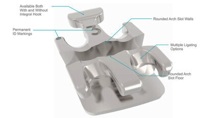 Selección de alambres en ortodoncia digital Selección de alambres en ortodoncia digital