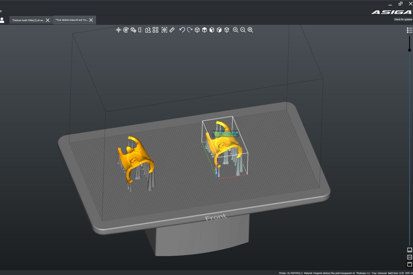 Fig. 2a: Denture base prepared for printing in Composer.