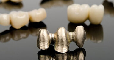 Aktuelle Trends bei Legierungen auf der IDS 2013