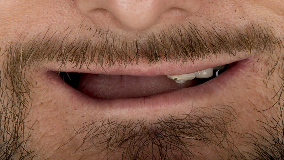 Figg. 1-3 - Fotografie preoperatorie. 