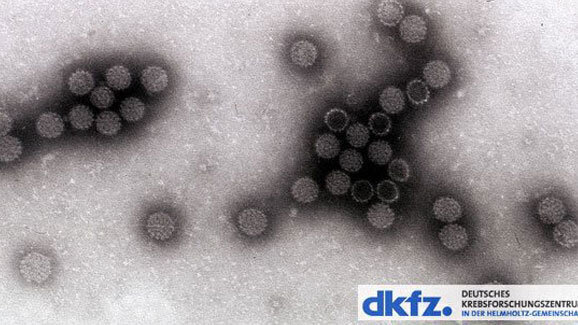 Biomarker für virusbedingten Krebs im Rachenraum gefunden