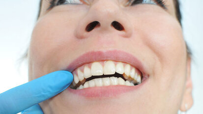 Fünfte Deutsche Mundgesundheitsstudie gestartet