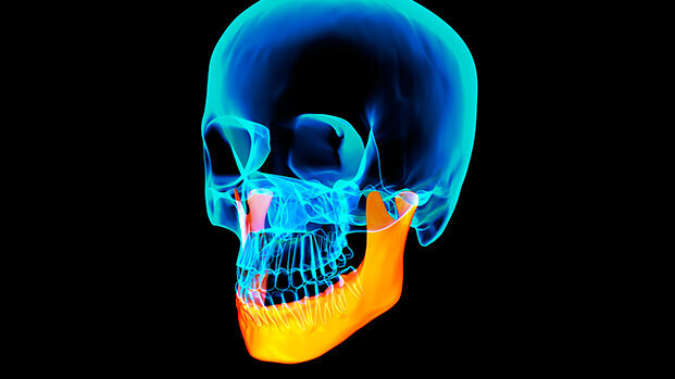 Primo trapianto di mandibola artificiale in Italia