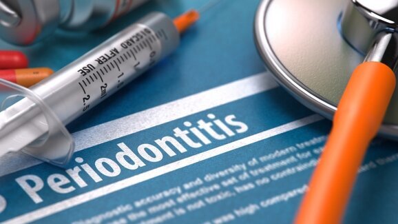 Nigeria: Many medical students have inadequate knowledge of periodontal disease