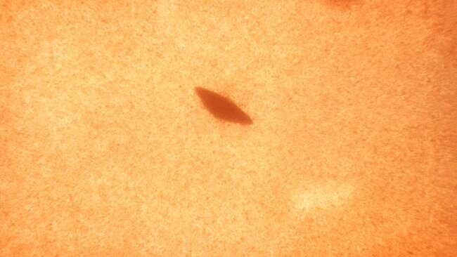 ‘Mondbacterie kan tandplakvorming remmen’