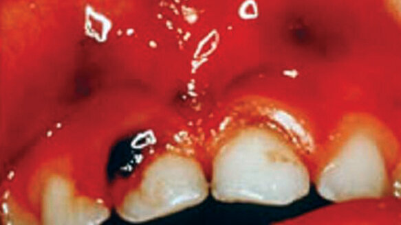 Identifying and responding to the drug-endangered child